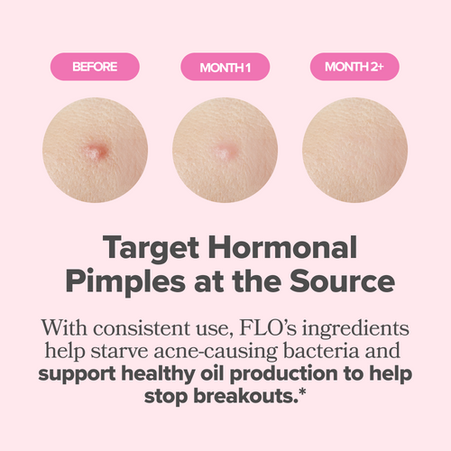 Hormonal Acne Vitamin Capsules